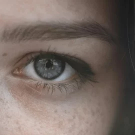 פיגמנטציה הורמונלית – סיבות, טיפול ומניעה